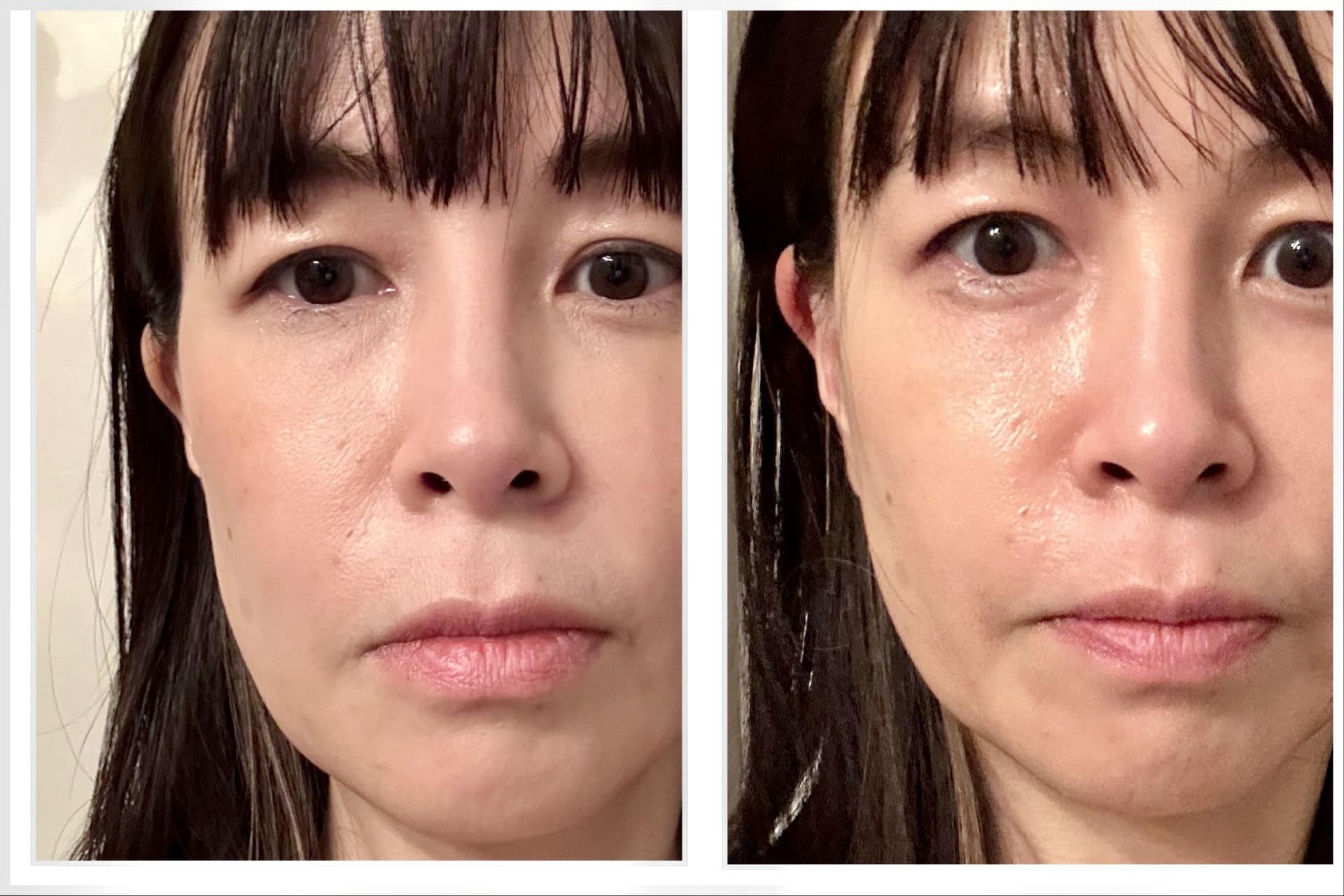 整形レベルに顔が激変!? 「プルヴォワール」の神の手エステティシャン