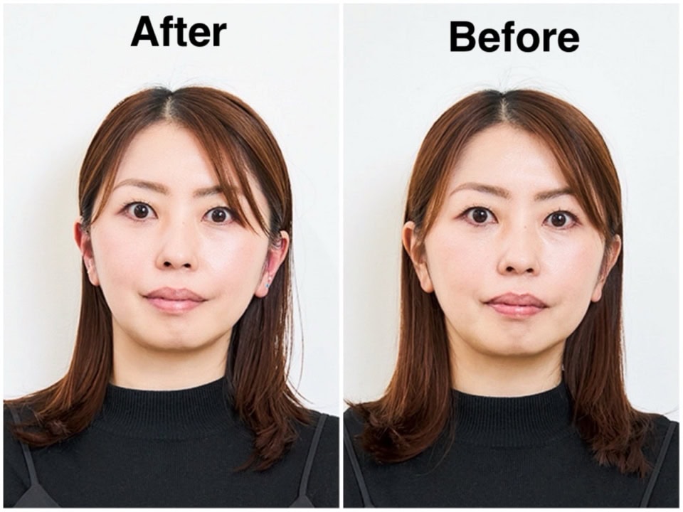1回でフェイスラインアップ！ 美容通を虜にする「耳つぼ」の劇的ビフォーアフター