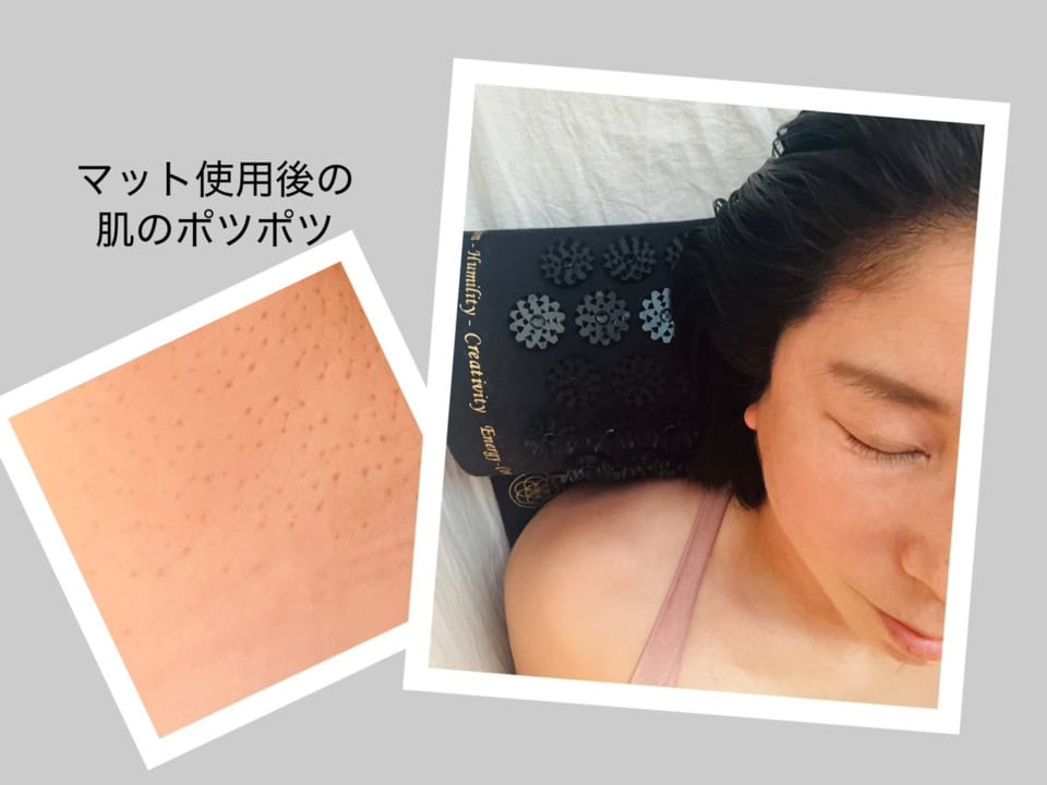 【美容編集・清水が実感】まさかの「痛い」が気持ちいいへ! “針のむしろ⁉”的「シャクティマット」でスッキリ爽快