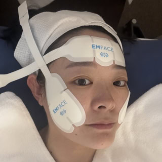 韓国で“ダウンタイムのない”新しいリフトアップ施術として話題を集めている「エムフェイス」