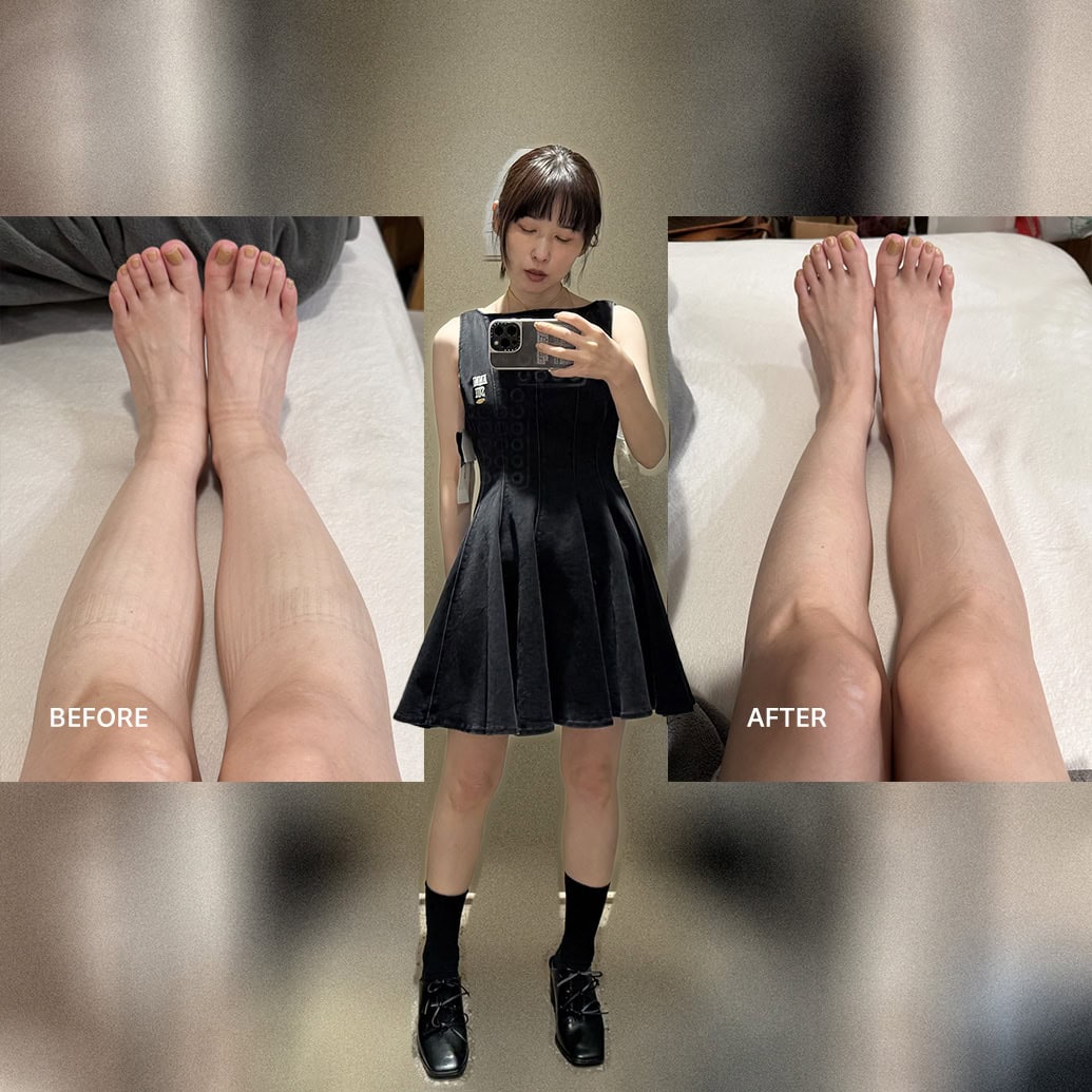 夏のむくみ対策】劇的に脚が細くなる！ 美容マニア・アダチミカ愛用の