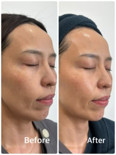 「ターゲットクール」のBeforeとAfter