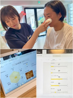 実際の肌状態を細かくチェックしていきます
