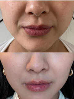 私がオーナーを務めているJOO_skinsalon（ヨー スキンサロン）でできます。