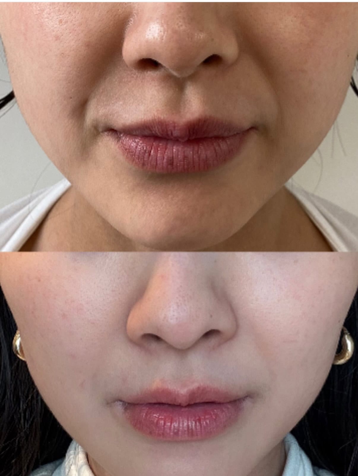 私がオーナーを務めているJOO_skinsalon（ヨー スキンサロン）でできます。
