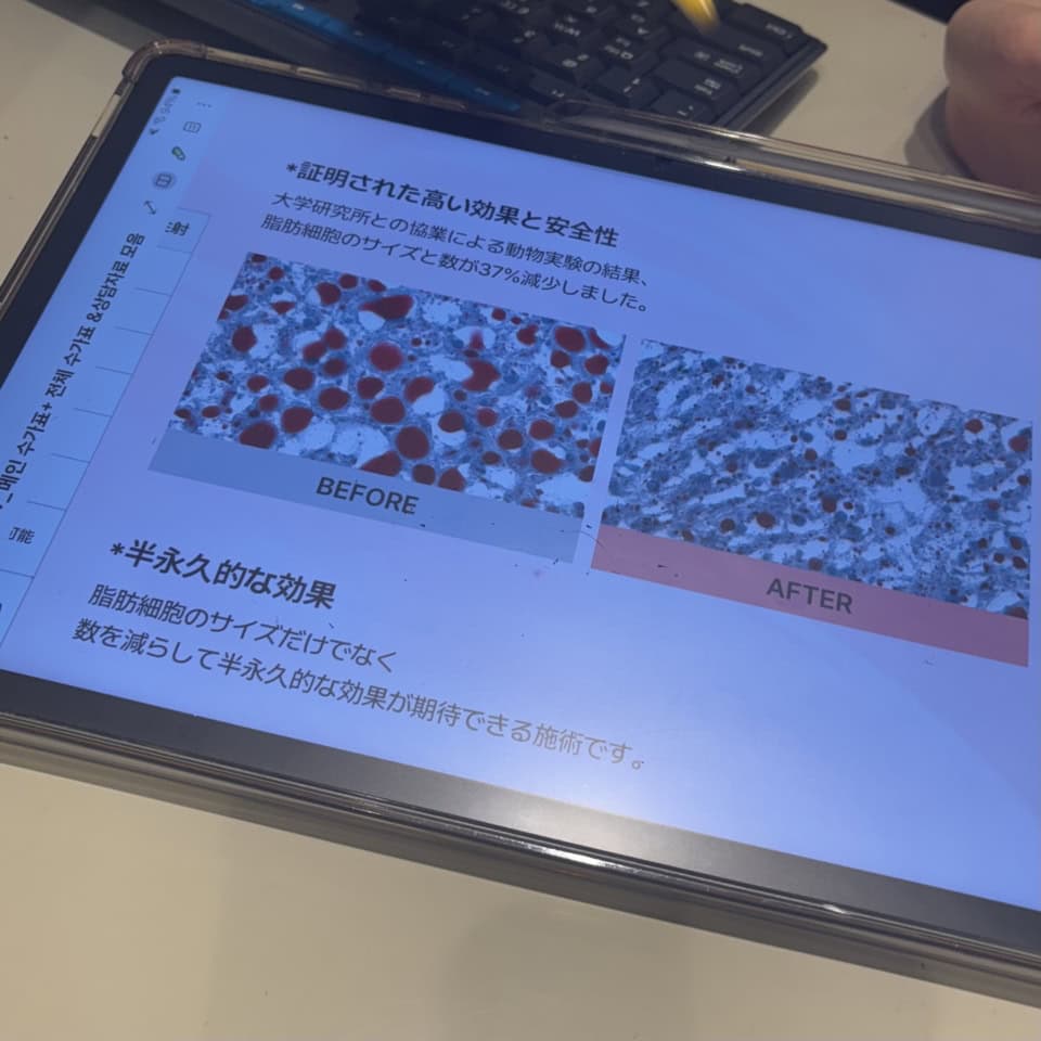 カウンセリングでは、体の脂肪量・筋肉量・水分量などをスキャニングして、そのデータをもとに体重目標や、どんな施術を組み合わせるべきかを相談していきます。