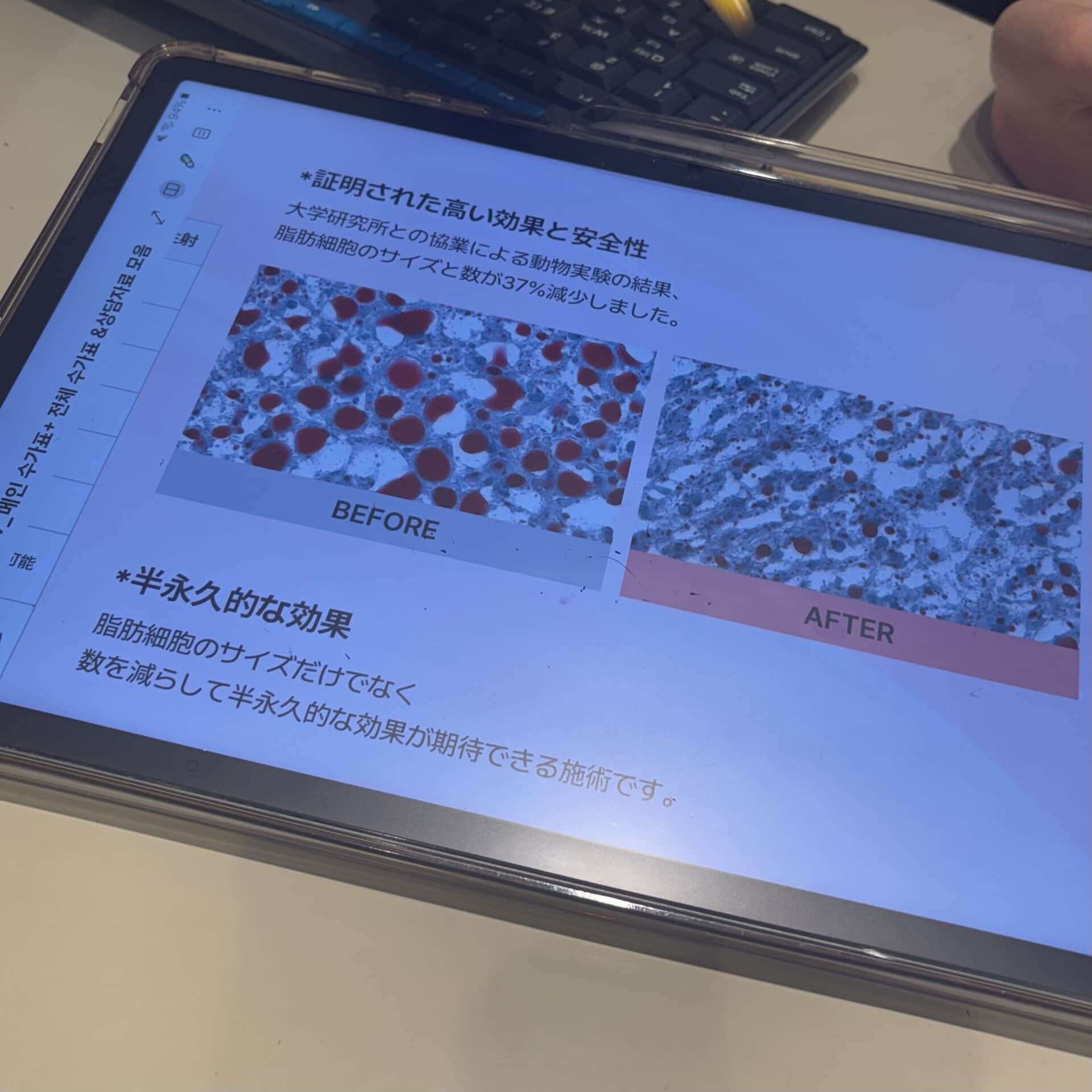 カウンセリングでは、体の脂肪量・筋肉量・水分量などをスキャニングして、そのデータをもとに体重目標や、どんな施術を組み合わせるべきかを相談していきます。