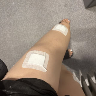 脂肪溶解注射は、予想の10倍は痛かったです（笑）。