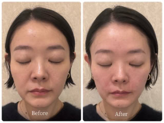 ビフォー＆アフターを公開！