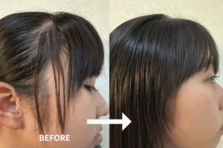 頑固だったうねり毛も、伸ばしながらブローするだけで驚くほどしなやかにまとまるようになりました。