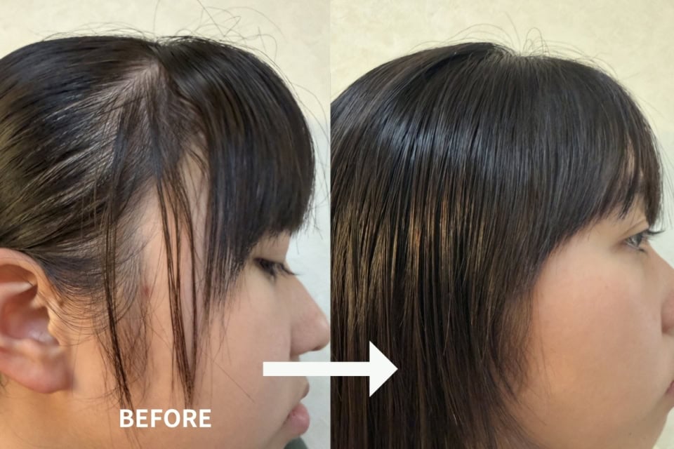 頑固だったうねり毛も、伸ばしながらブローするだけで驚くほどしなやかにまとまるようになりました。