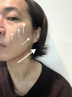 施術前に比べて目に見えてすっきりしたフェイスラインと実感が高かった目のすっきり感!