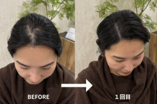 分け目の白さが目立たなくなり、髪全体のボリュームが底上げされたような印象に!