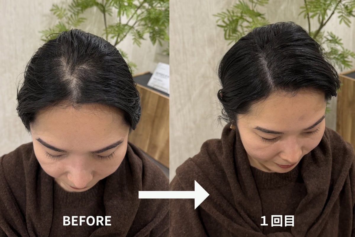 分け目の白さが目立たなくなり、髪全体のボリュームが底上げされたような印象に！