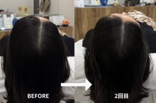 分け目の地肌が完全に隠れることで、髪の一本一本が根元からギュッと締まった印象に!