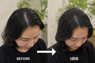 2回目を終えると「元からフサフサだった?」と錯覚するほど馴染んでいます。