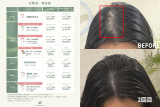 悩みの範囲に合わせた明快な料金プランが用意されています