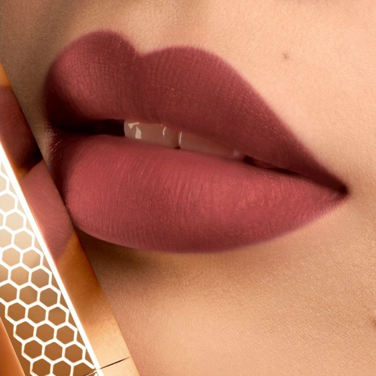 396 ピオニーキス