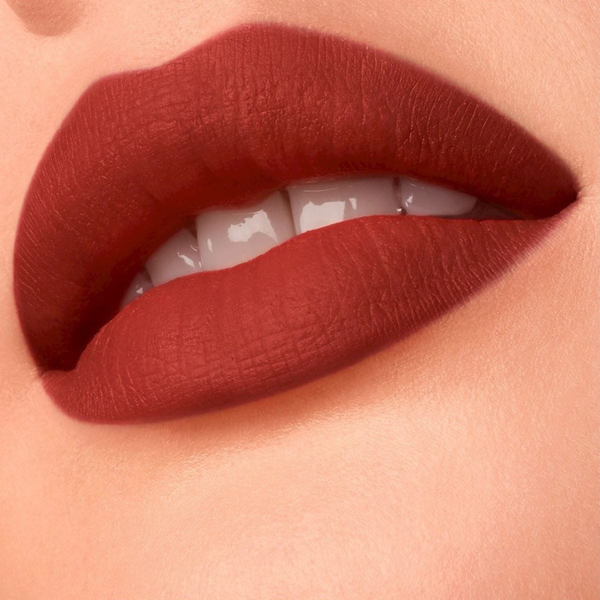 599 レッドアスター