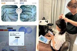 施術の最初に行う最新のAI頭皮診断、頭皮の状態から、脱毛指数や毛包の密度など詳しく診断。自分に必要なケアが見つかります。
