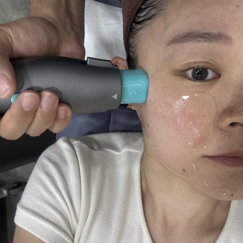 「顔の輪郭を取り戻したい」たるみ改善の最適解【オリジオ】を42歳韓国在住ライターがお試し!