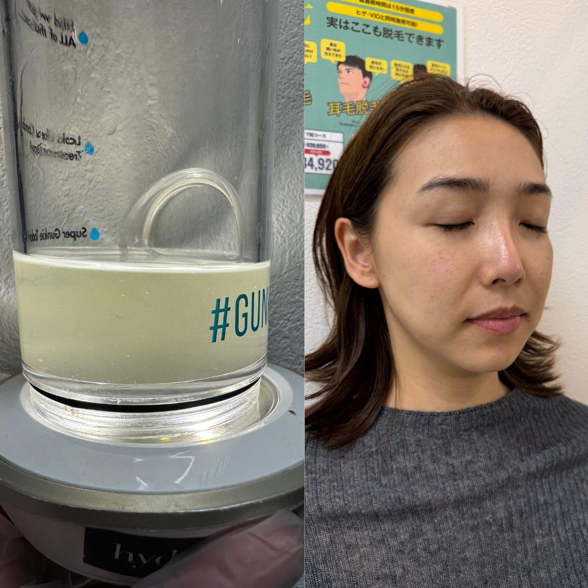今回は日頃のケアのおかげで汚れは比較的少ない方でしたが、皮脂分泌の多い男性などの場合、もっと黒い廃液が出てくることもあるそう…!目に見えて効果を実感できるのがハイドラフェイシャルの醍醐味です。