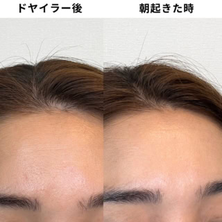 ドライヤー後も、翌朝起きた時も、根元からへたらずふんわり!使い続けることで頭皮環境が健やかに整い、大人が悩みやすい「朝起きた時の独特な頭皮のニオイ」も気にならなくなりました!