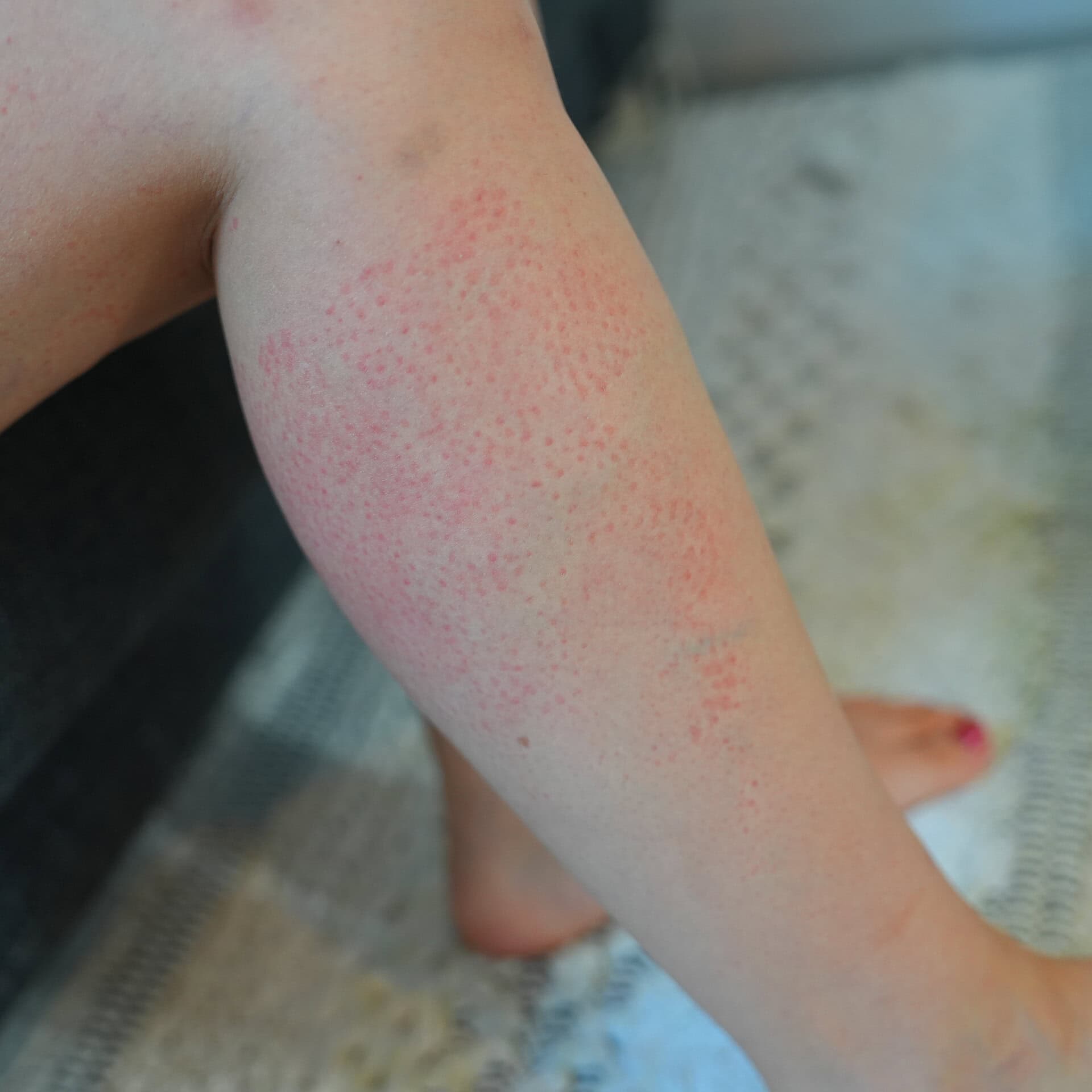 正直これが一番痛かった…（笑）！外した瞬間一気に血行が良くなって、重かったふくらはぎが驚くほど軽くなる極上体験。