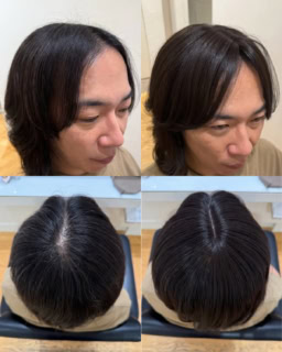 【白髪・薄毛】ペタッと貼って秒で解決!40代の救世主「シールエクステ」衝撃のビフォアフ