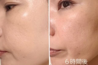 手に取り出した時のこっくり感から「夕方に重く崩れるかも?」と思いきや、6時間経過しても毛穴落ちは皆無。ピタッと肌にフィットし続けたまま、適度なツヤが溢れ出るようなヘルシーな仕上がりを持続してくれます。