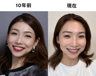 20代の私は毎日このくらい全てをガッツリ盛るのがデフォルト。アイメイク、リップ、そして笑顔まで全力投球。今これだと完全にイタ見え!この『過剰な盛り』がイタ見えへの近道だったかも…(笑)