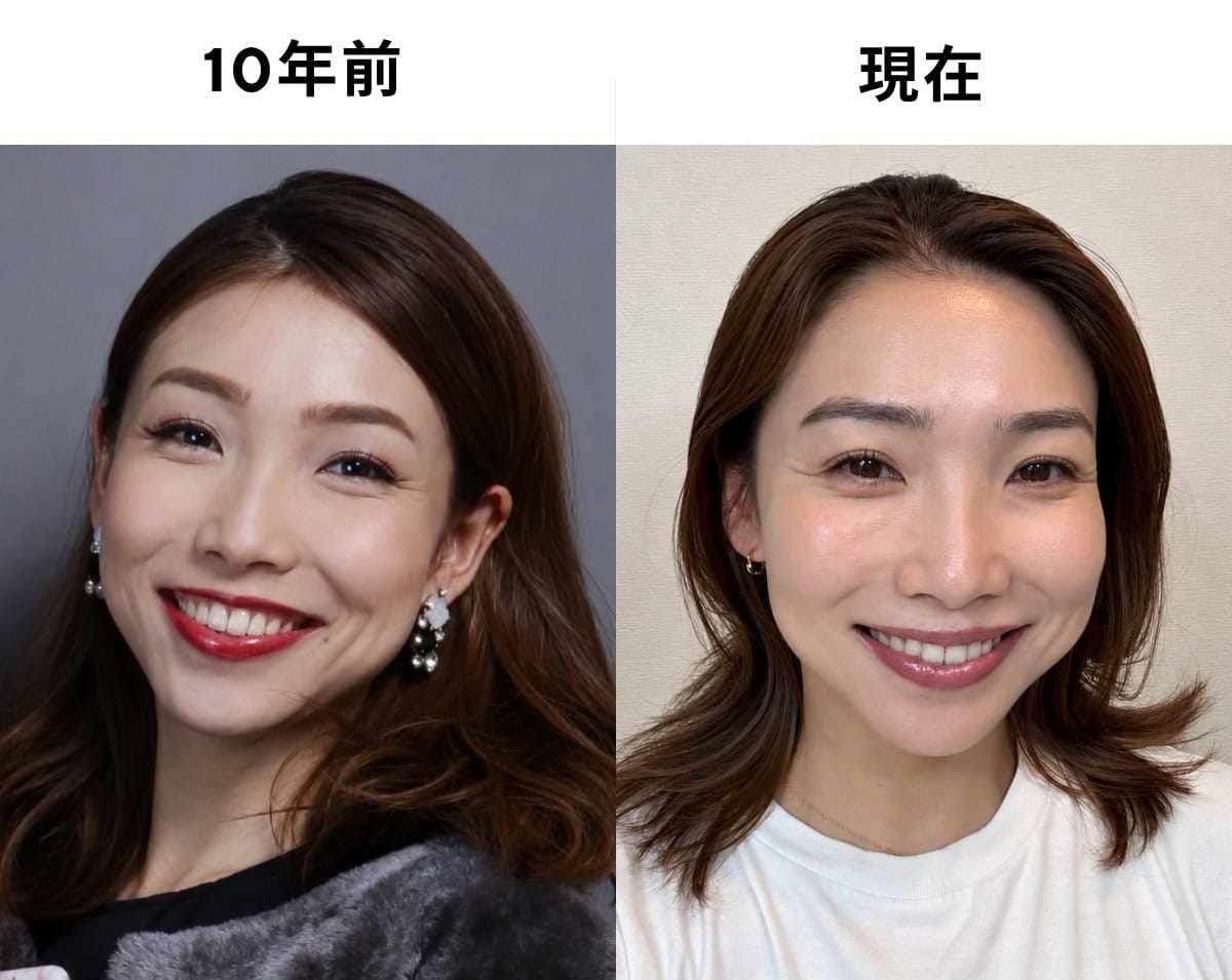 20代の私は毎日このくらい全てをガッツリ盛るのがデフォルト。アイメイク、リップ、そして笑顔まで全力投球。今これだと完全にイタ見え！この『過剰な盛り』がイタ見えへの近道だったかも…(笑)