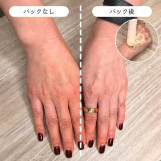 左右でこの差に全員がびっくり!たった一度の使用で、巡りが良くなり、古い角質やくすみがオフされてパッと明るい印象に!