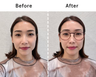 物理的に顔が縮むわけじゃないのに、かけるだけでこの差！Beforeだと、目の下の余白が気になりますが、メガネの縦幅とチークレンズの効果で、頬の余白がキュッと埋まってキュートなバランスに見えるのが分かりますか…!? JINS Combination Titanium ［中顔面短縮メガネ］ 全3色 ¥14,900（ジンズ）