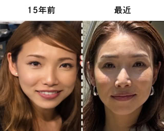 人からは「そんな変わらない」と言われても、自分の中では「なんか顔伸びた…?」と違和感でいっぱい。メイクや美容医療以外のリアルな解決策を探した理由がここにあります!